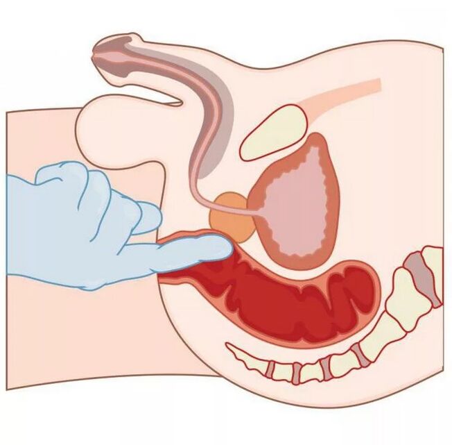 Umiestnenie mužského bodu G
